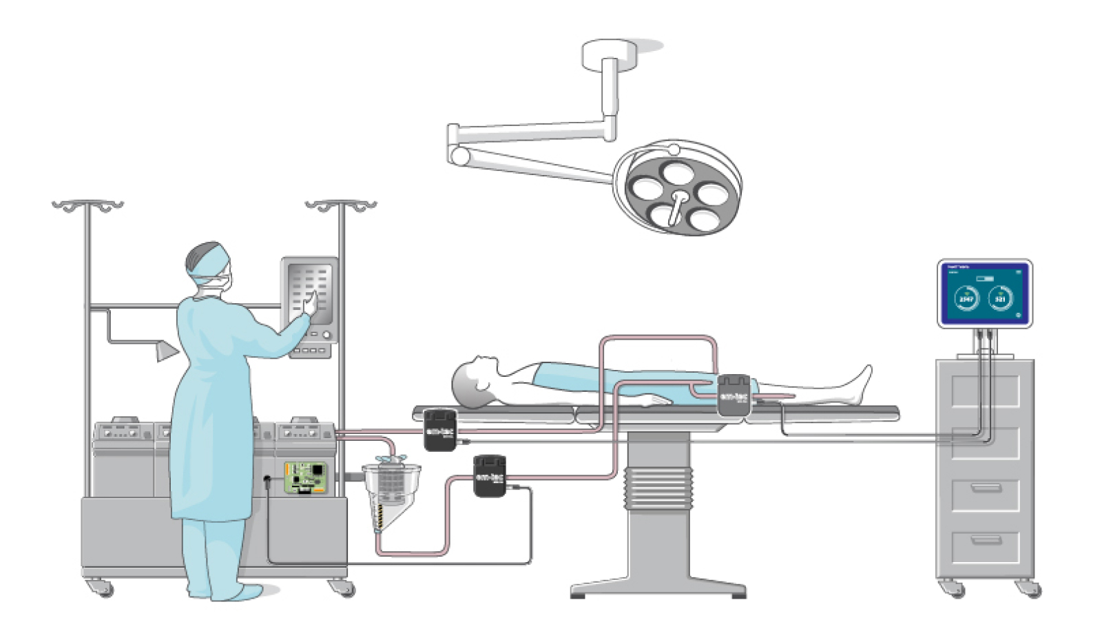 Heart-Lung Machine (HLM) Diagram