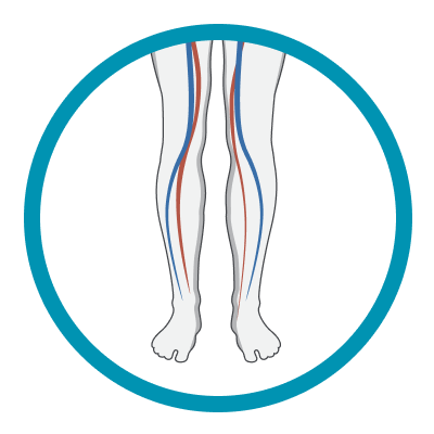 Distal Perfusion Icon