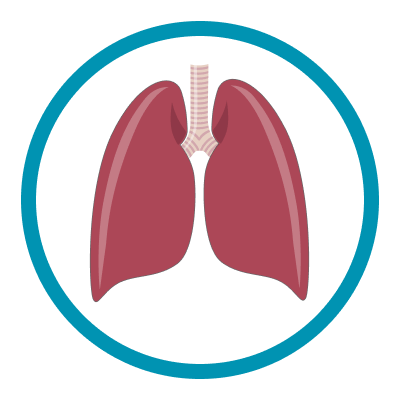 Extracorporeal Membrane Oxygenation (ECMO) Icon