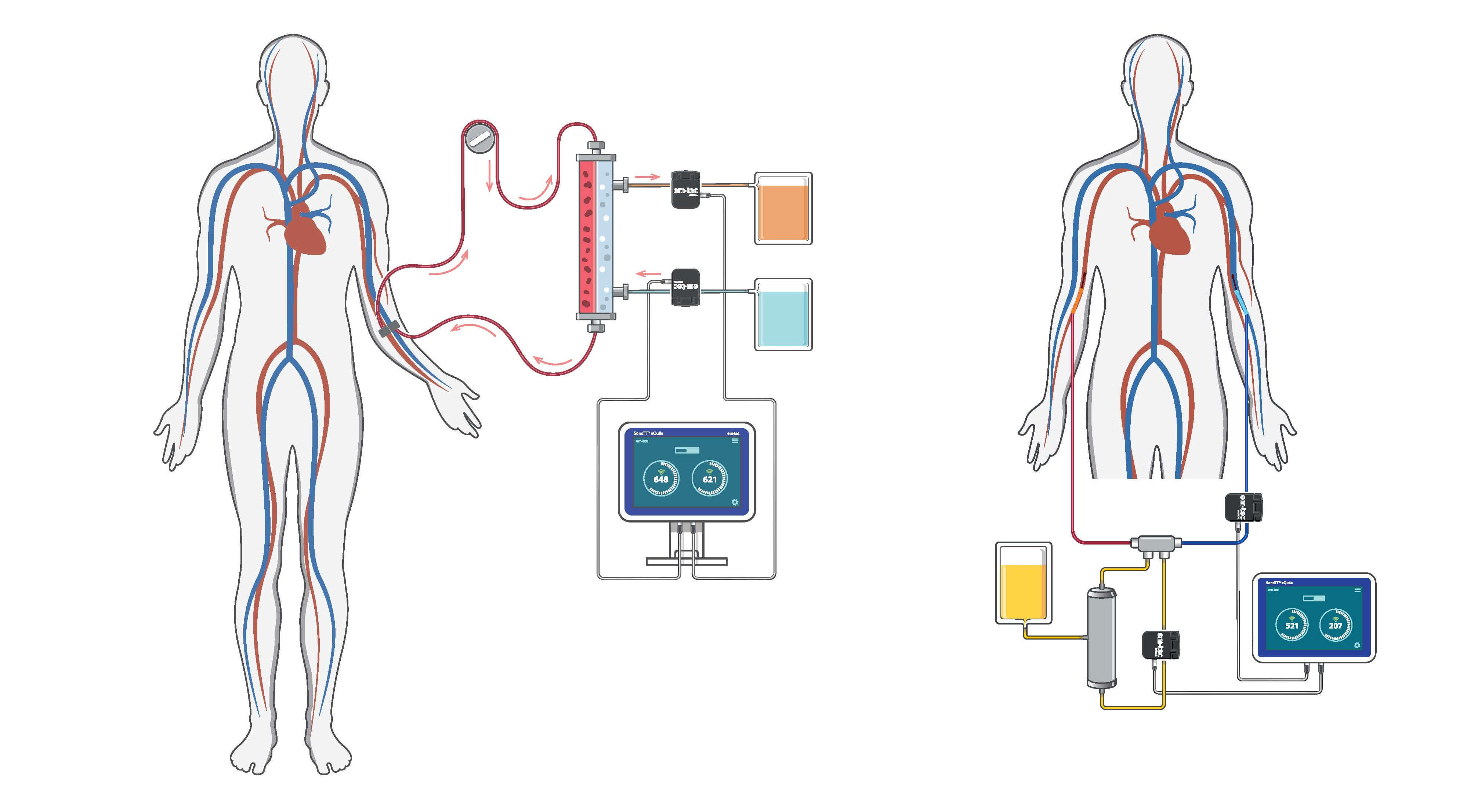 Dialysis & Apheresis